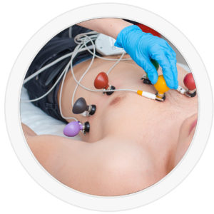 electrocardiogramme